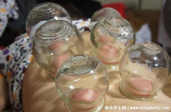 拔罐顏色癥狀對照表圖解，深淺代表不同病癥(越淺越好)