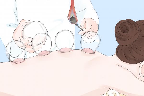 拔火罐有什么好處-易網(wǎng)健康<a href=http://m.henggaotouzi.com/jkys/ target=_blank class=infotextkey>養(yǎng)生</a>網(wǎng) 拔火罐有什么好處